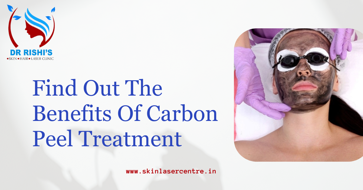 Find Out The Benefits Of Carbon Peel Treatment